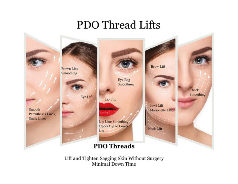 PDO Threads on woman's face