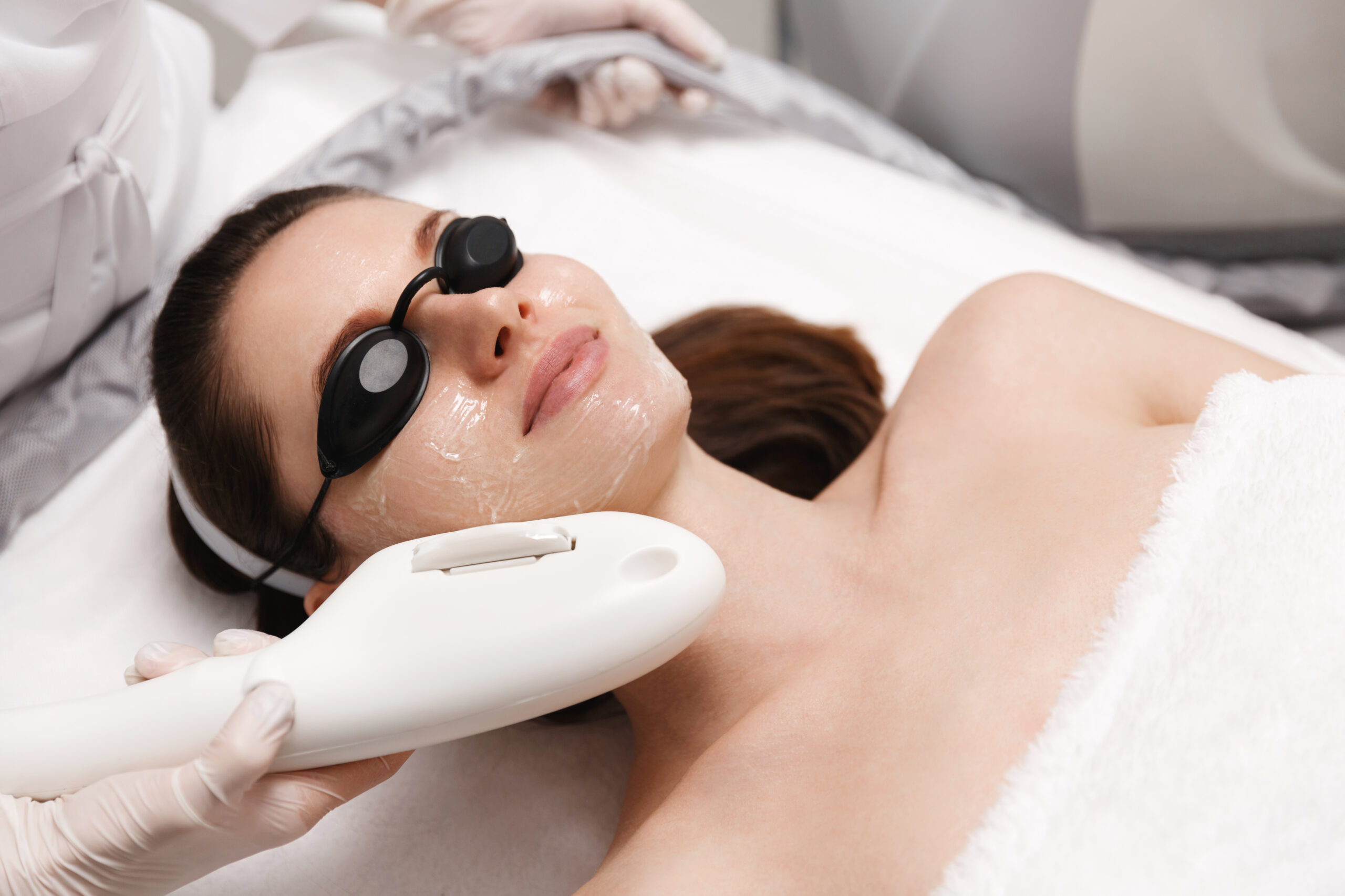 Woman under IPL treatment for skin rejuvenation and treating skin from blemishes.