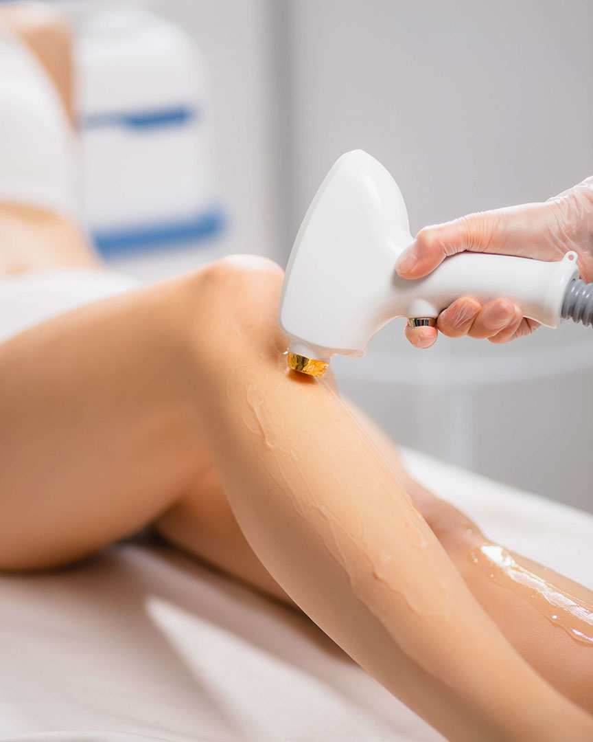Laser Hair Removal Services at Beauté Therapies
