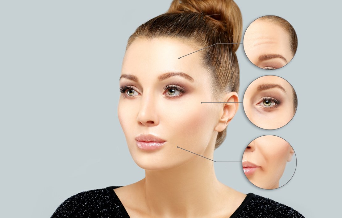effect of botox and filler on a women's face